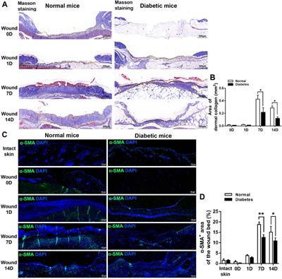 Diminished schwann cell repair responses play a role in delayed diabetes-associated wound healing